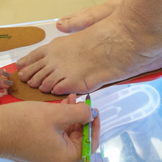 Изготовление индивидуальных стелек.